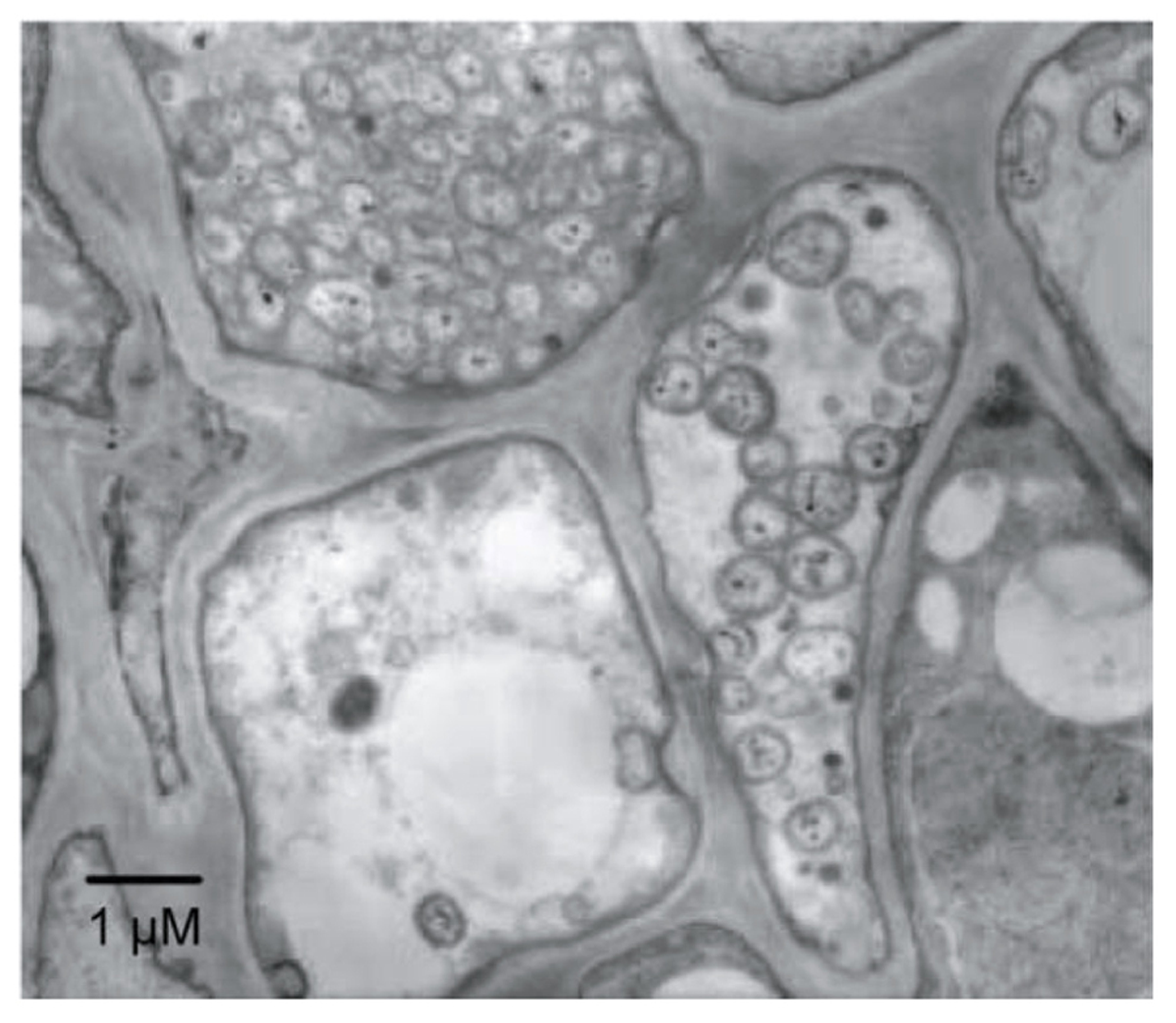 Electron microphotograph of Candidatus Phytoplasma asteris infecting the plant phloem